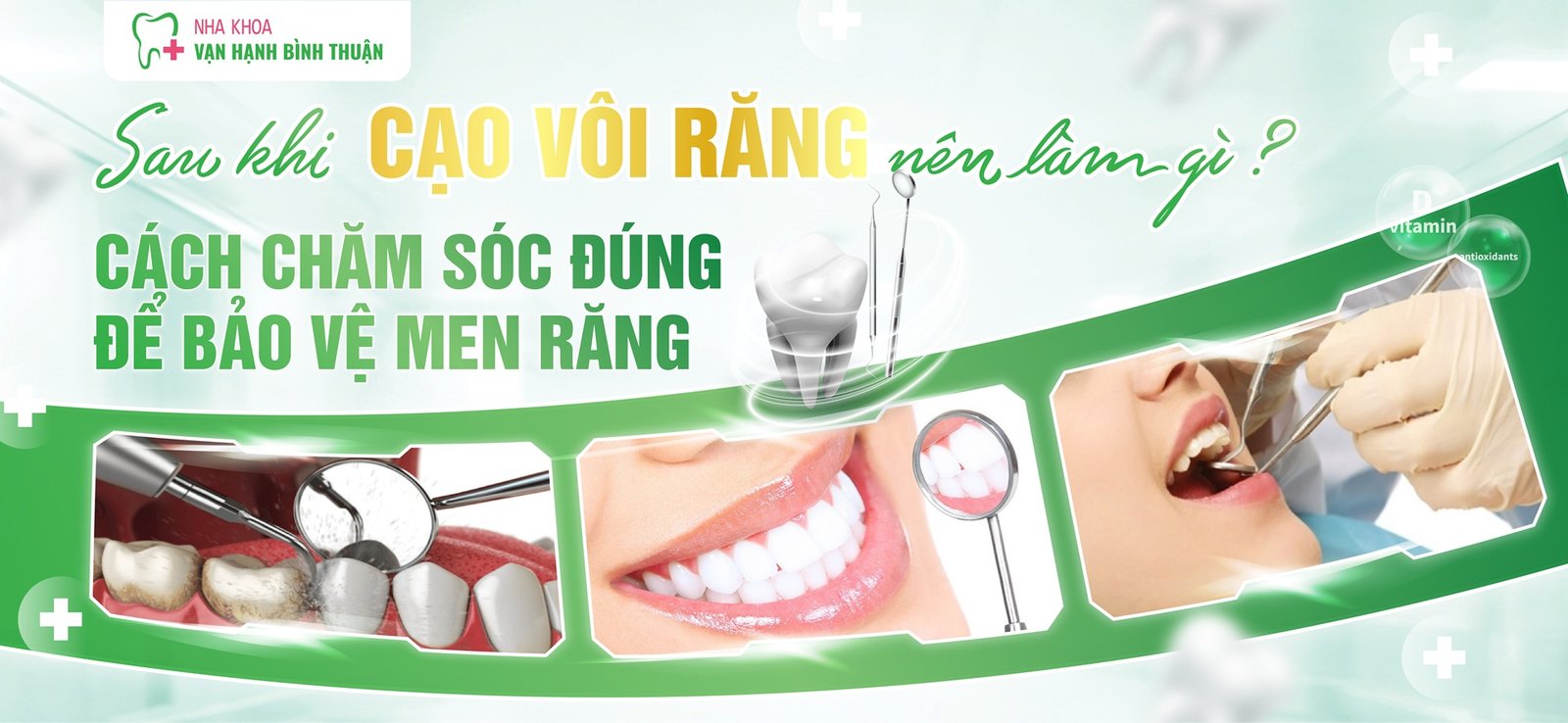 Sau khi cạo vôi răng nên làm gì? Cách chăm sóc đúng để bảo vệ men răng